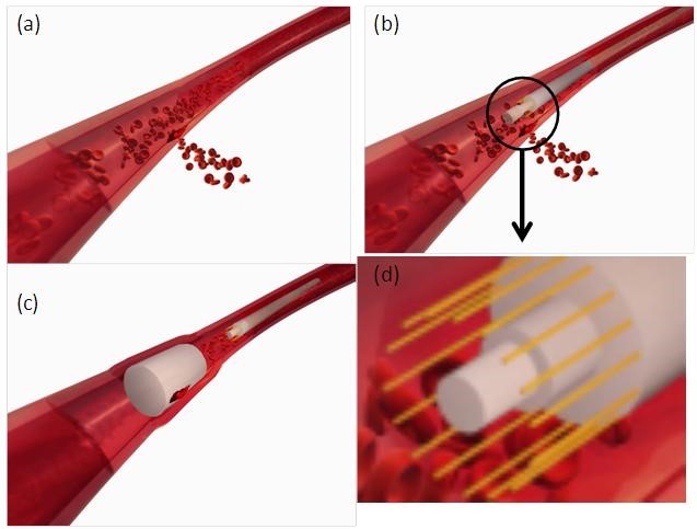 Expandable hydrogel delivery device used for stemming blood leakage in cardiovascular vessel